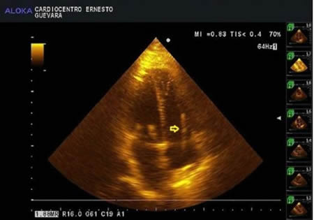 Figura 3