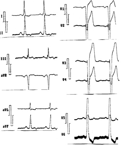 Figura 3