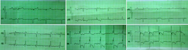 Figura 2