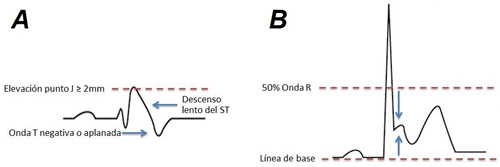 Figura 2