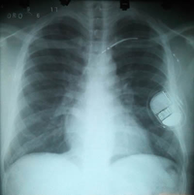 Figura2