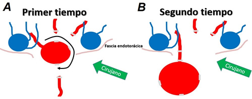 Figura 2