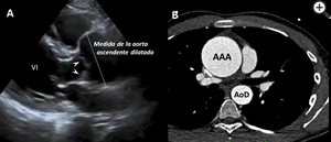 Figura 2