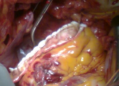 Figura4