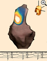 Figura 1
